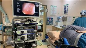 大腸鏡（門諾醫院提供）