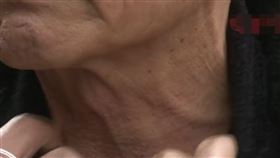 回春,醫美,老翁,71歲,欺騙