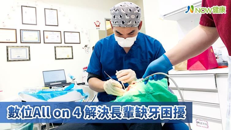 數位All on 4拯救大範圍缺牙