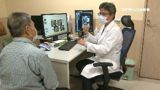 晚期肝癌腫瘤變小　6旬翁成罕見病例