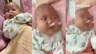 月子中心爆群聚　6嬰感染RSV病毒