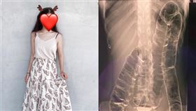「大腸長到心臟」23歲女大生曝心聲（圖／媛西授權提供）