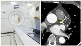 全景寶石電腦斷層（台北慈濟醫院提供）