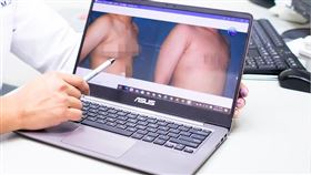 東元醫院,男性女乳症,少男,新竹,（圖／東元醫院提供）