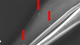 泰籍移工吃生豬肉、下半身莫名疼痛　X光一照…腿內竟長蟲（圖／亞大醫院提供）