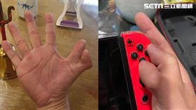 6根手指頭！罕見六指男挨轟「怪物」　現況曝光網讚：天生外掛
圖／葉先生授權提供