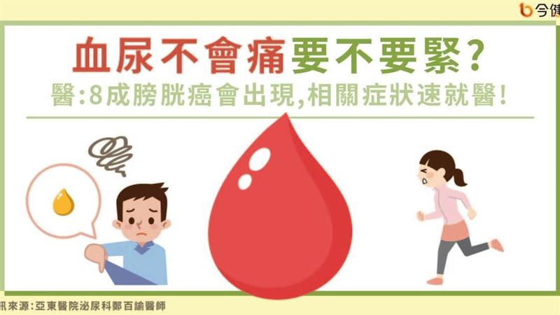 血尿無痛不要緊？8成患有膀胱癌！