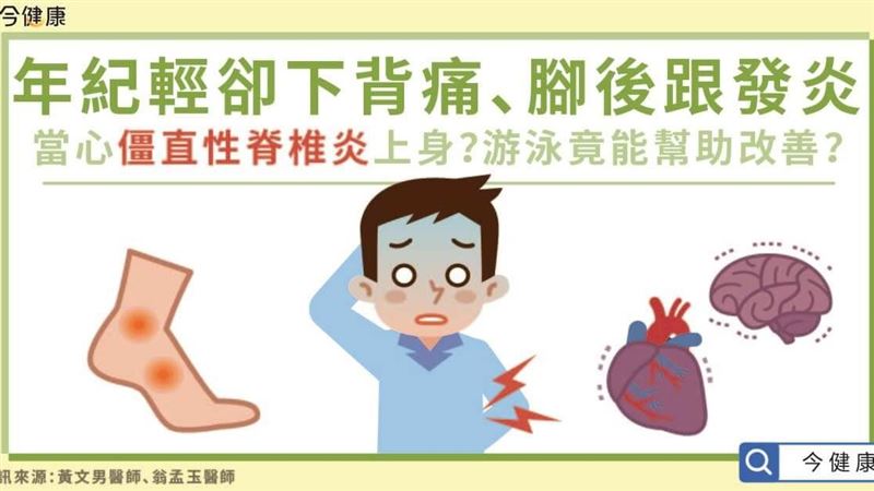 下背痛是僵直性脊椎炎？醫指常見症狀