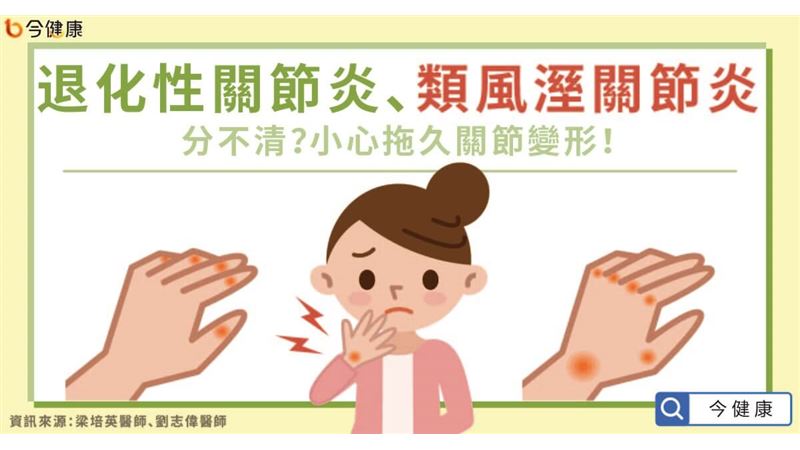 退化性關節炎 類風溼關節炎分不清 小心拖久關節變形 名家 三立新聞網setn Com 退化性關節炎 類風溼關節炎分不清 小心拖久關節變形 名家 三立新聞網setn Com