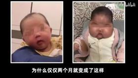 ▲嬰兒疑似使用了激素藥膏。（圖／翻攝自漳州市衛健委）