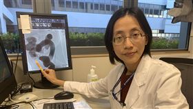 腸套疊,中國醫大新竹附醫,小兒科,（圖／中國醫大新竹附醫提供）