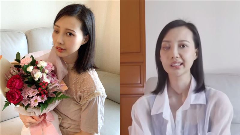 癌細胞爬滿身　女星抗癌9年拋大喜事