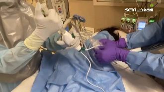 插管患者易咳　飛沫四散醫護首當其衝