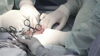 結紮前求別真做曝原因…醫傻眼反笑說1句