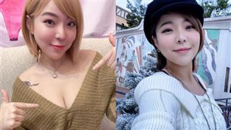 宛宛兒買3房曝心酸　嘆身留永久瘡疤