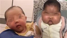 中國又出現家長誤用劣質產品，造成嬰兒頭部異常發育、甚至額頭長毛的「大頭娃娃」，涉案商品則是抑菌霜。（圖取自魏文鋒嗶嚦嗶嚦網頁bilibili.com）