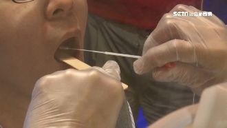 男染變種搭車採檢醫疑破口　阿中說明