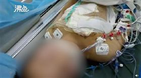 醫師9歲兒遭砍50刀！嫌犯竟是喉嚨痛病患：他沒把我醫好 （圖／翻攝自沸點視頻）