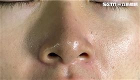 ▲小編阿期體驗清粉刺，一開始滿滿草莓鼻。（圖／社群中心提供）