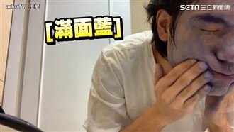 他誤用染髮劑洗臉　全是女友搞的鬼