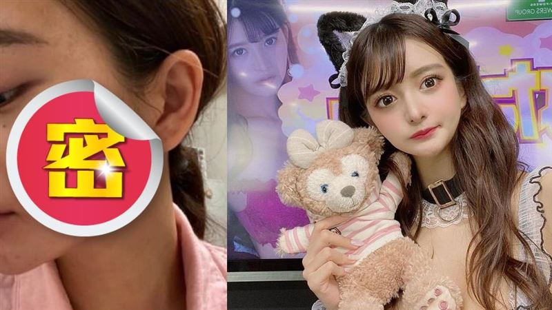 滿臉疤！23歲美女曝「超爛臉」素顏