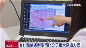 ▲因冬天皮膚會比較乾燥，表皮紋路會看起來更明顯。