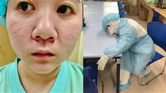 桃醫護理師全臉壓痕　尪心疼曝趴桌照