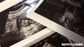 專題【小光點】