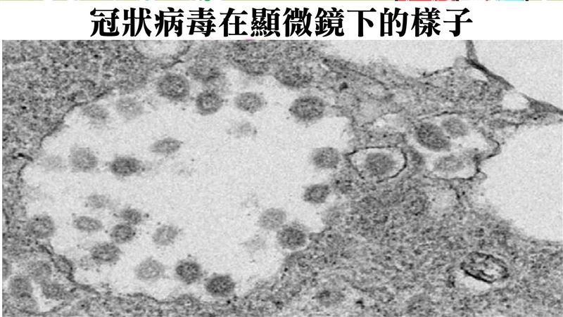 醫警告：一咳恐噴出千萬隻新冠病毒