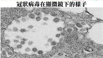 醫警告：一咳恐噴出千萬隻新冠病毒
