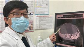 吃幾口就飽　竟是因為肝臟有顆大水球（南投醫院提供）