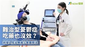 名家專用／NOW健康／重複性透顱磁刺激術即是透過儀器產生磁場變化，誘發大腦微電流刺激特定腦區，以活化腦部原有的功能，平衡神經傳導物質，此療法可以有效地改善憂鬱症狀並縮短病程。(勿用)