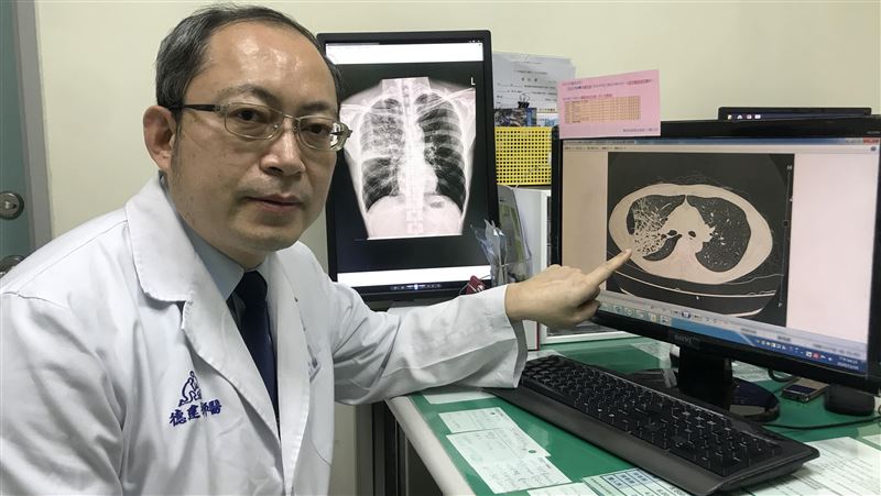 肺部舊疾復發肺炎！男子連呼吸都會痛