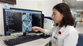 翁慧鈴醫師提醒，55歲以上熟男要注意，若有尿滯流、尿不出來問題，就應到醫院找專科醫師做超音波、尿流速檢查（圖／大林慈院提供）