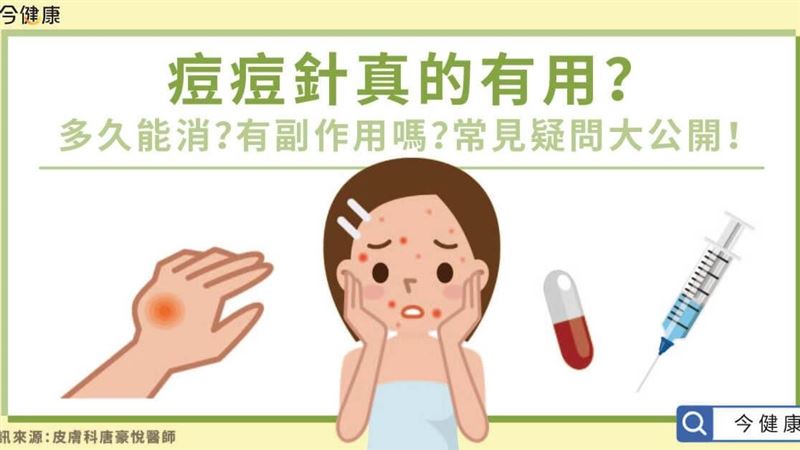痘痘針真的有用嗎？常見疑問大公開！