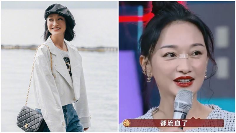 才宣布離婚　周迅破相上節目：都流血