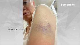 L炮炸狗挨打2400