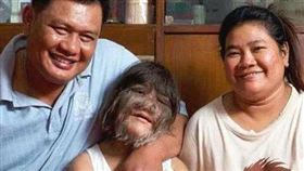 ▲泰國狼人女孩為愛刮毛。（圖／翻攝自百度百科）