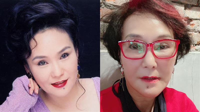媚眼女星罹乳癌　醫生：只剩3年生命