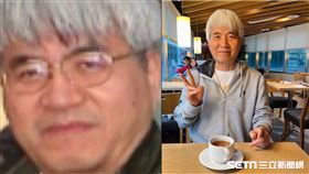 醫師凍齡術／謝興霖醫師授權提供