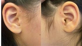 耳前廔管　魚腮　科學家（圖／記者潘靚緯拍攝）