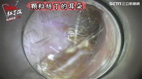 ▲小編顆粒絲丁耳道毛過於長，與耳垢黏在一起較難清除。（圖／社群中心提供）