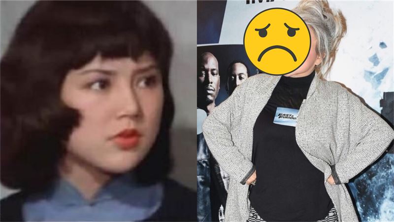 女星2百元整形　跌倒半張臉撕開毀容