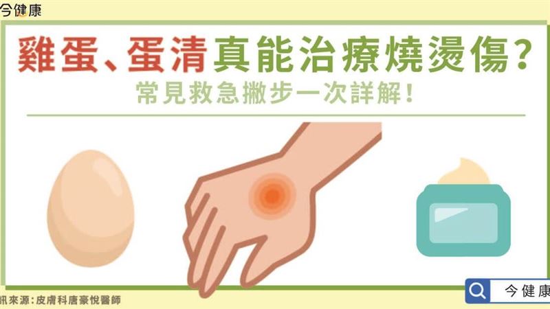 雞蛋、蛋清真的能治療燒燙傷嗎？