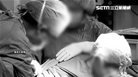 開刀、手術／資料照