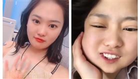 中國,山東,智齒,牙醫（圖／翻攝自沸點視頻）