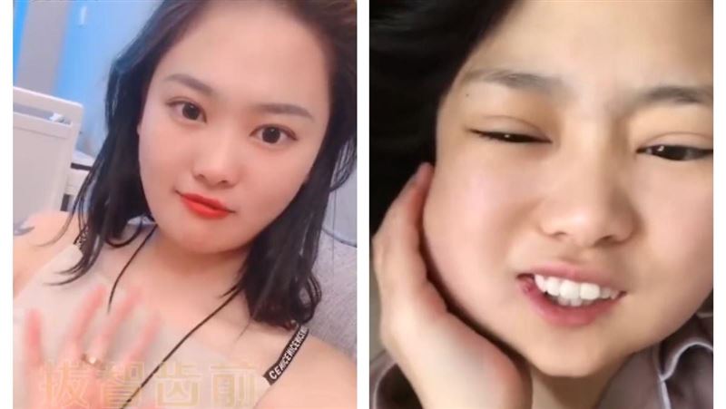正妹一次拔3智齒　起床一照鏡子哭了