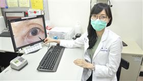 萬芳醫院眼科主治醫師江明璇表示，根據她的觀察，門診約有1至2成的老人家會出現睫毛倒插的問題（圖／萬芳醫院提供）