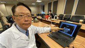 周固曾收治一名59歲男子，過去曾有PSA升高病史，但沒再追蹤，去年底因排尿困難檢查，PSA竟高達271.33ng/ml，切片確診攝護腺癌。（圖／記者簡浩正攝影）