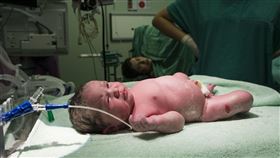 新生兒分娩(圖／pixbay)